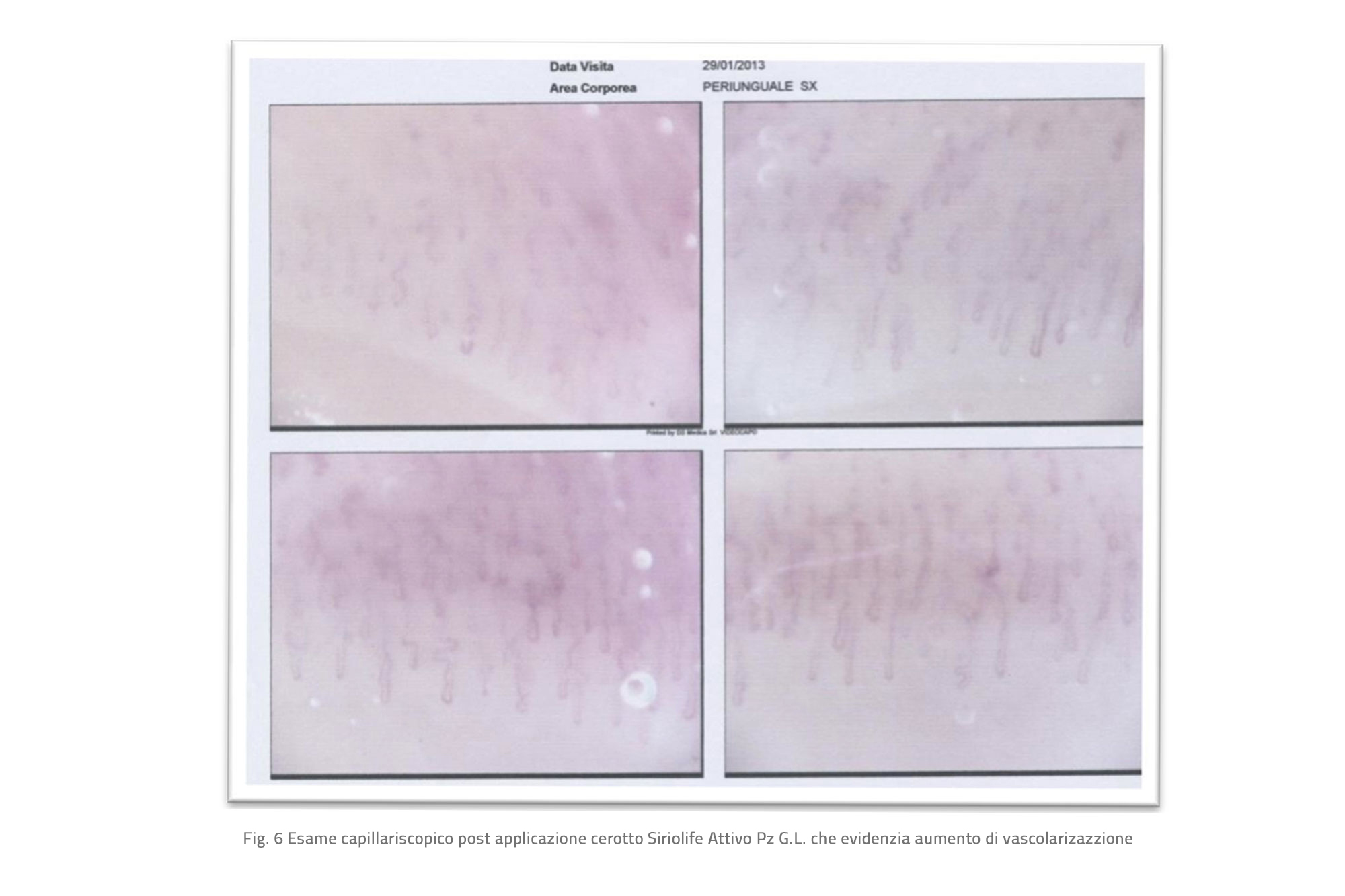 Standard Post with Image